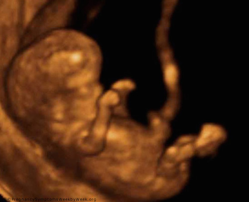 Ultrasound image of a fetus during the 12th week of pregnancy