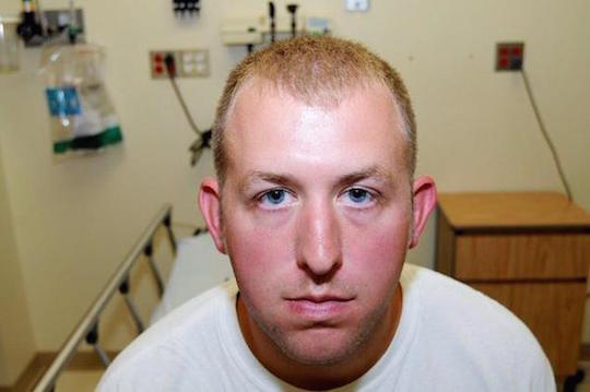 Officer Darren Wilson in the hospital, hours after being attacked by Michael Brown